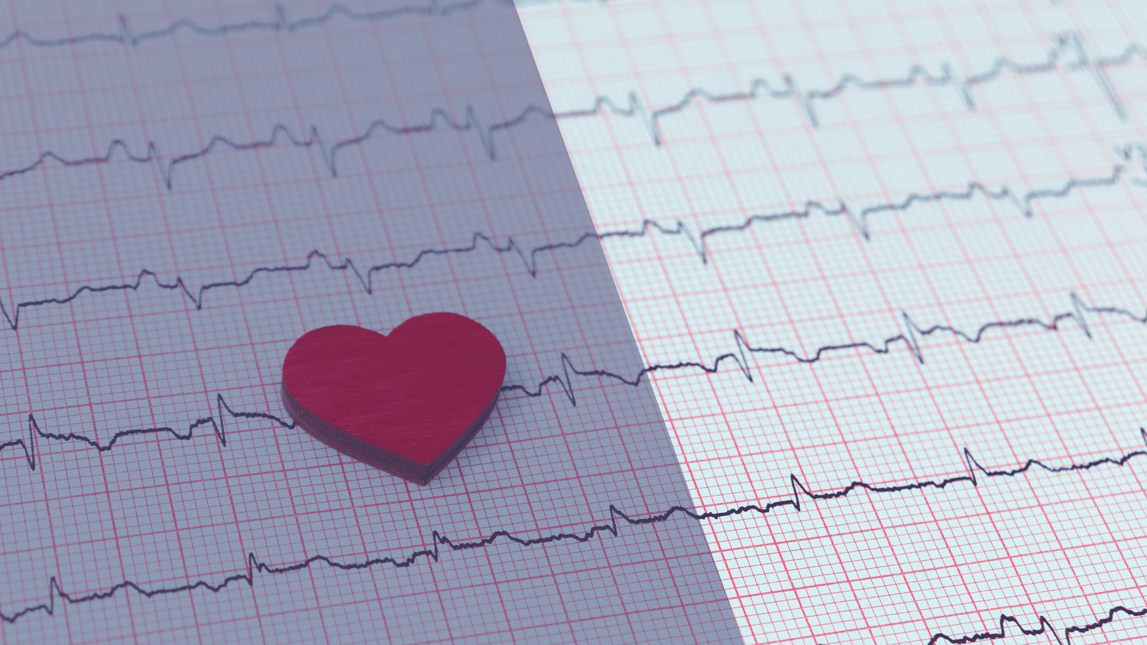 Heart Rate Monitoring Best Practices for Accurate Data
