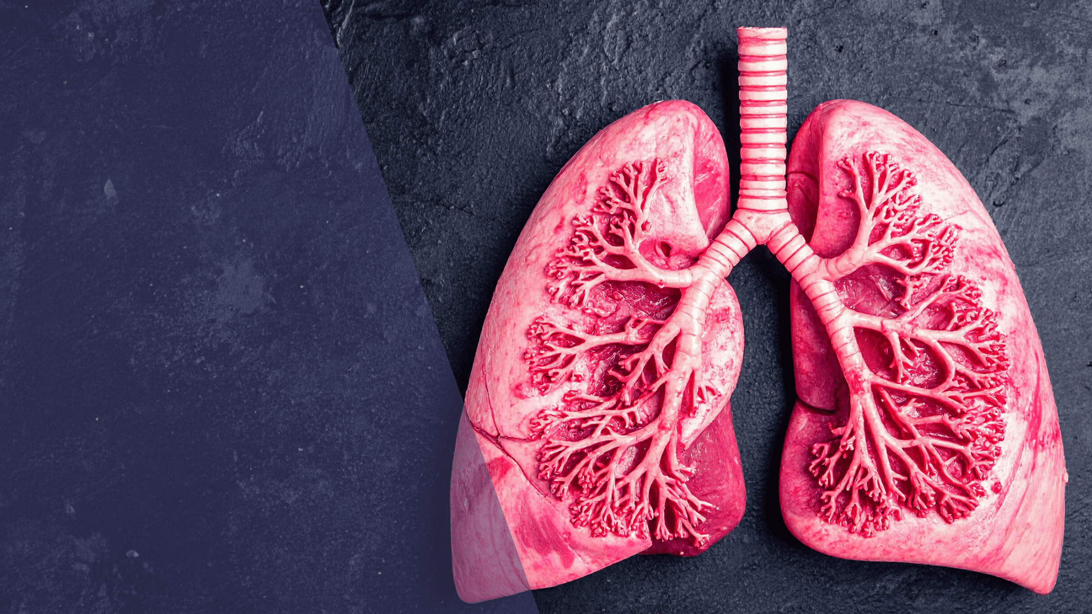 Respiratory and Cardiac Limitations: What Your VO₂ Test Can Reveal